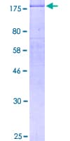 Human ERBB2 / HER2 Protein (Recombinant GST)