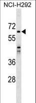 SNX33 Antibody (aa389-416)