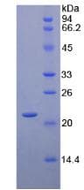Human CD8B / CD8 Beta Protein (Recombinant His-T7)