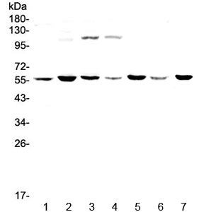 CHRNA3 Antibody