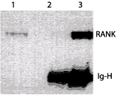 TNFRSF11A / RANK Antibody (Extracellular Domain, clone 64C1385.1)