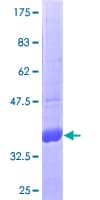 Human Leptin Protein (Recombinant GST)
