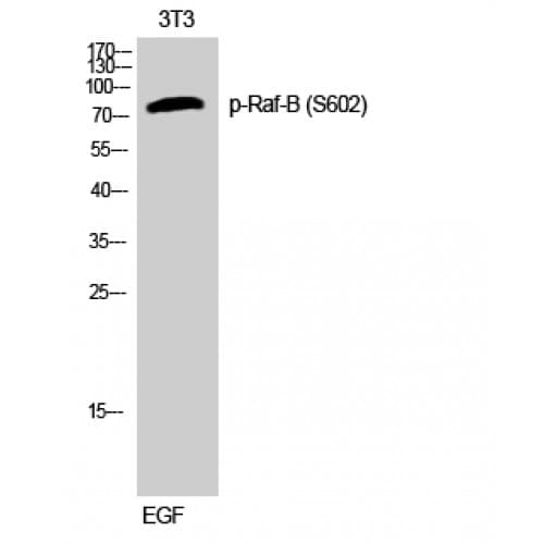 BRAF / B-Raf Antibody (550-630 aa)