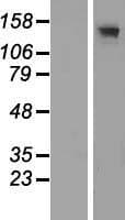 Human ADCY3 / Adenylate Cyclase 3 Protein (Over-Expression Lysate Myc-DDK (Flag))