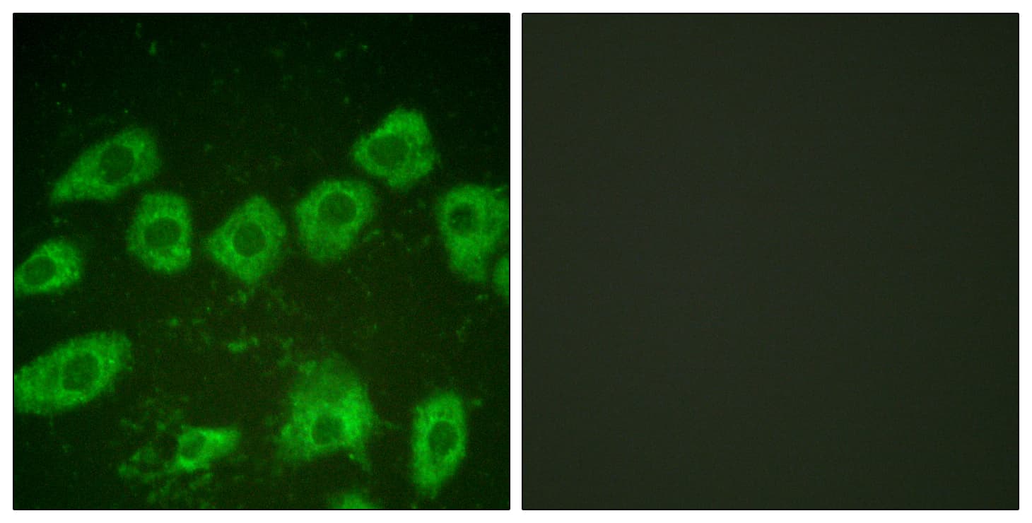Polyclonal Rabbit anti-Human TH / Tyrosine Hydroxylase Antibody (aa10-59, IHC, IF, WB)