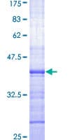 Human DDB2 Protein (Recombinant GST, N-terminus)
