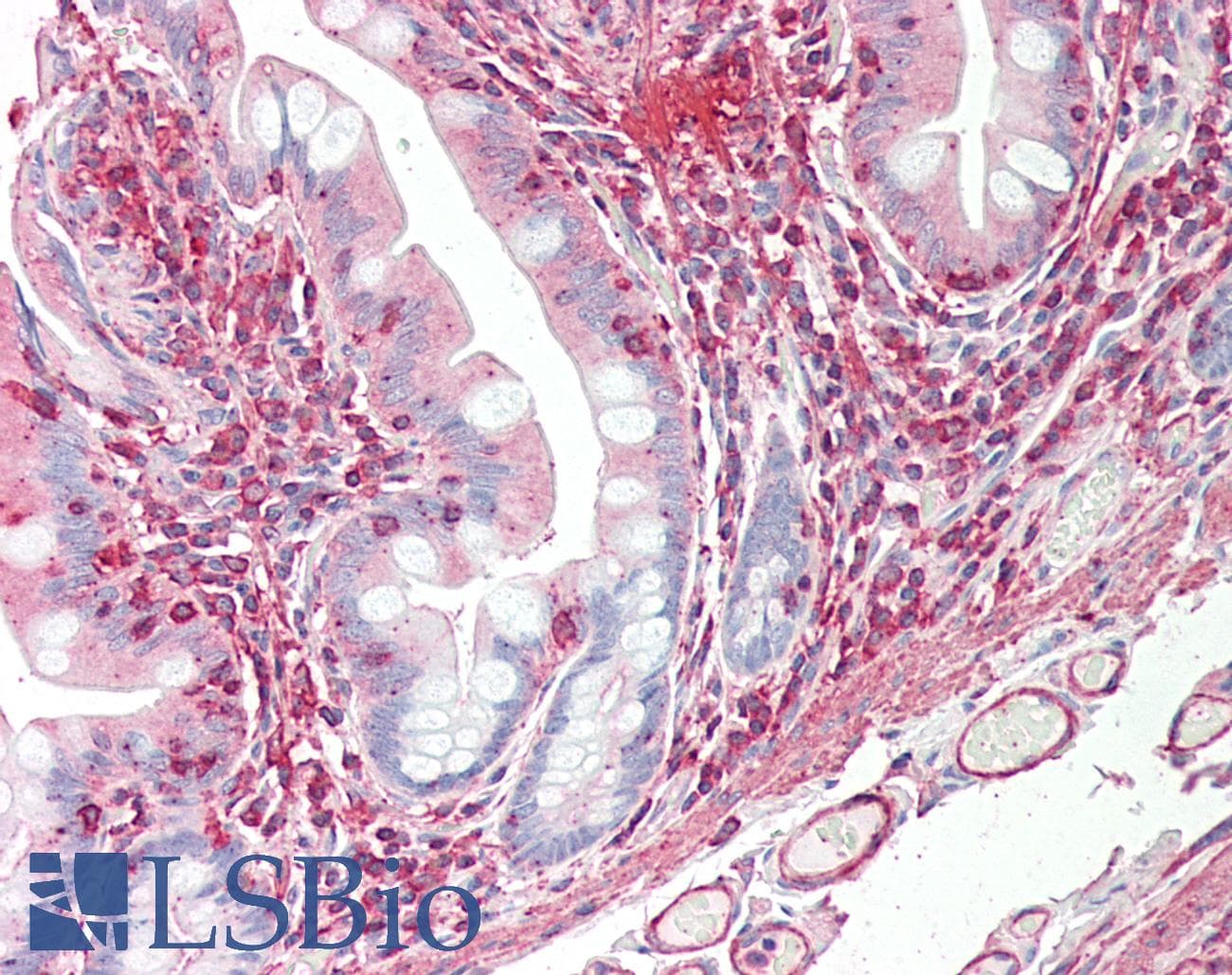 PathPlus™ VEGFC Antibody