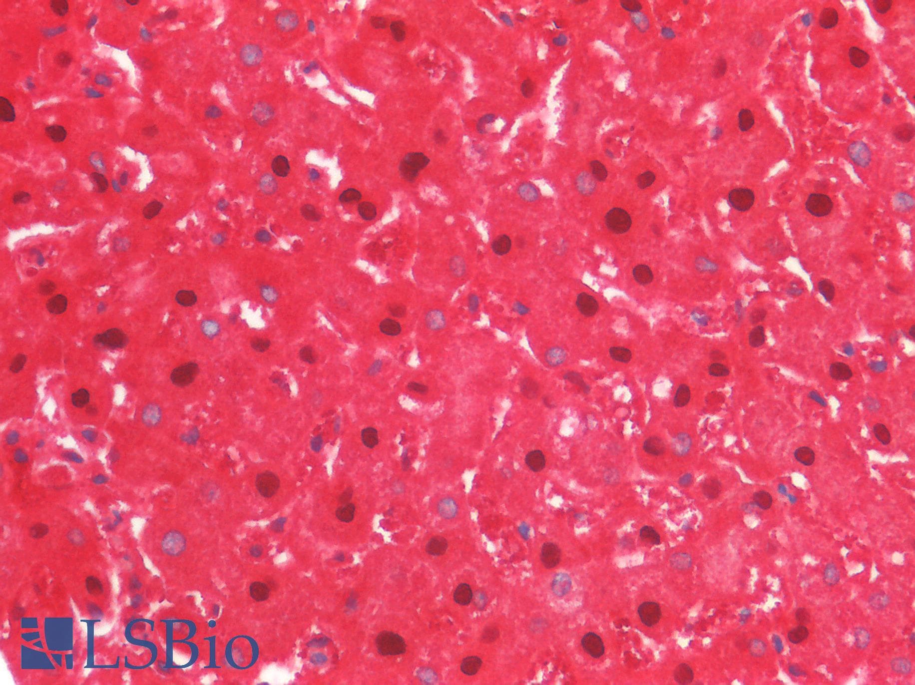 ARG1 / Arginase 1 Antibody (aa1-322, clone C7)