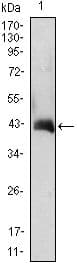 CSF2 / GM-CSF Antibody (Amino Acid: 18-144, clone 3D3)