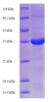 Horse EPO / Erythropoietin Protein (Recombinant His-SUMO)