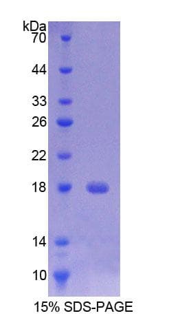 Rat TMEM27 / Collectrin Protein (Recombinant His-T7)
