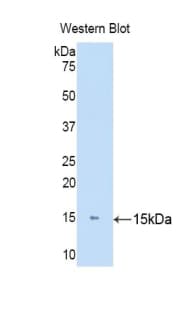 KRT81 / Keratin 81 / KRTHB1 Antibody (aa142-257)