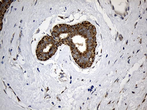 Monoclonal Mouse anti-Human ALDH7A1 Antibody (clone OTI10A12, IHC, WB)