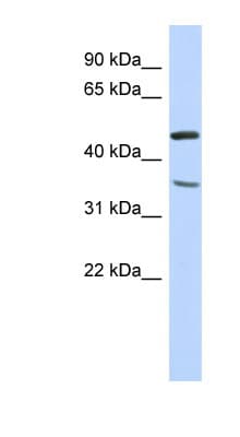 FAM81B Antibody (N-Terminus)