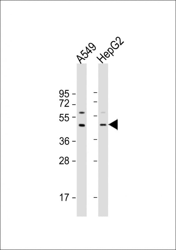 Polyclonal Rabbit anti-Human APOL3 / Apolipoprotein L 3 Antibody (N-Terminus, WB)