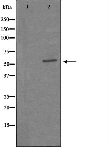 CAMKV Antibody