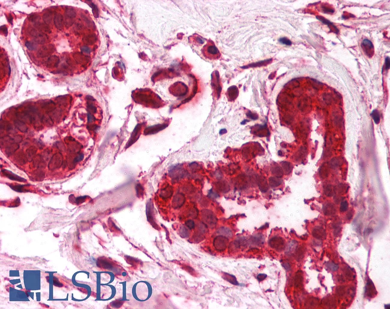 Polyclonal Rabbit anti-Human FOXO3 / FOXO3A Antibody (C-Terminus, IHC, WB)