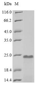 Human PTMA / Prothymosin Alpha Protein (Recombinant 10His, N-terminus)