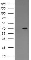 MAPK13 / p38delta Antibody (clone OTI2G1)