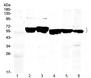 KRT8 / CK8 / Cytokeratin 8 Antibody