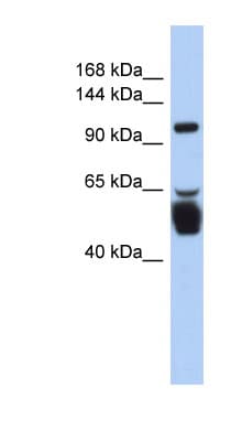 LRRC8B Antibody (aa143-192)