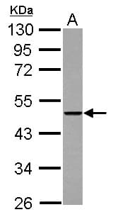 Polyclonal Rabbit anti-Human THUMPD2 Antibody (IHC, WB)