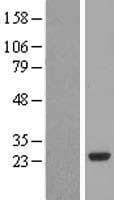 PCTP Protein (Over-Expression Lysate Myc-DDK (Flag))