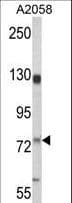 Polyclonal Rabbit anti-Human MCAM / CD146 Antibody (aa161-189, IHC, WB)