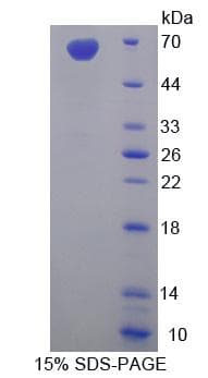 Human SYNC / SYNCOILIN Protein (Recombinant His-GST)