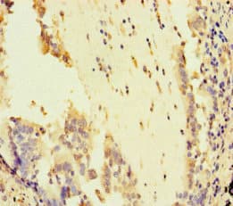 ATR Antibody