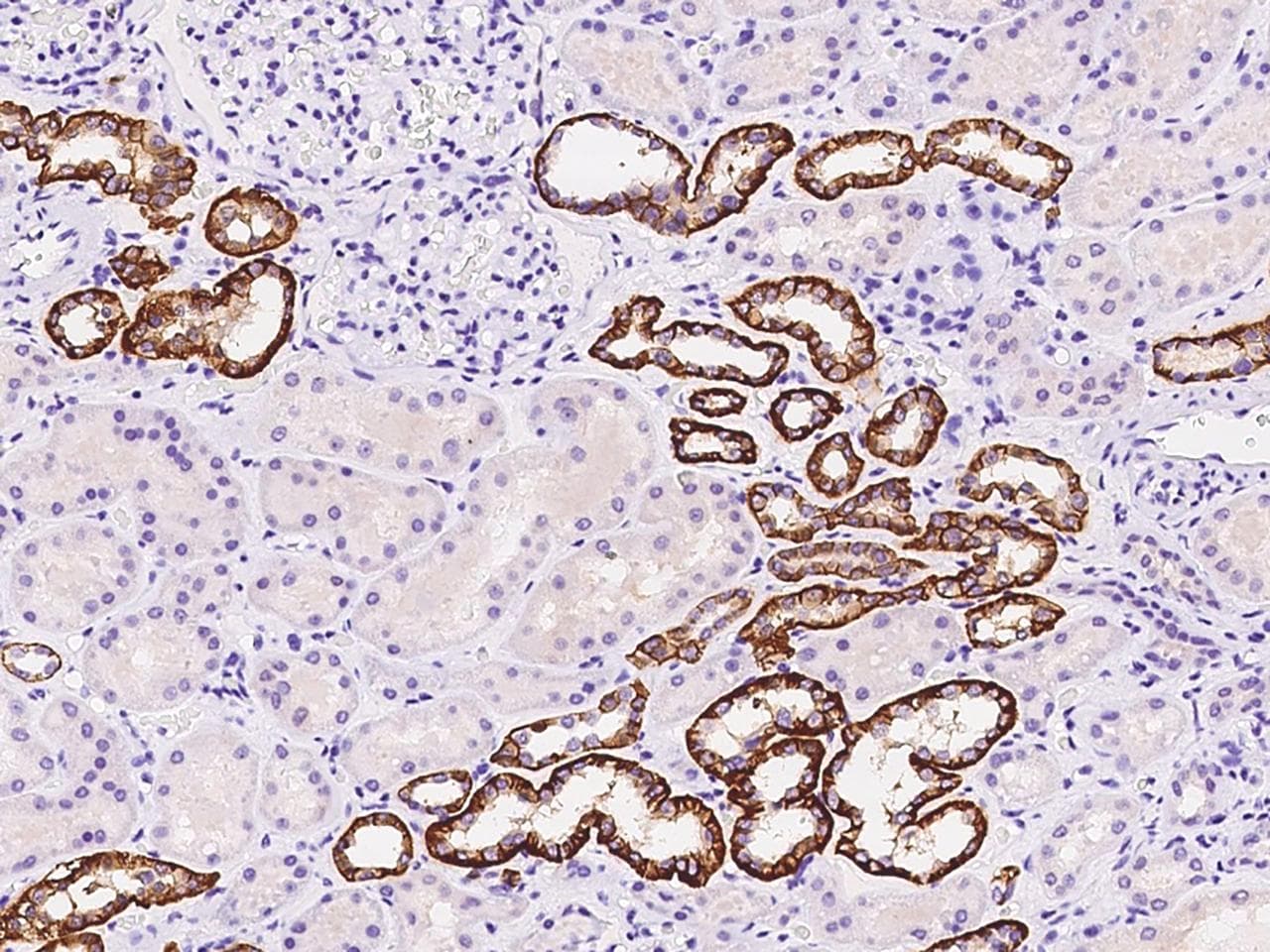 BSND / Barttin Antibody