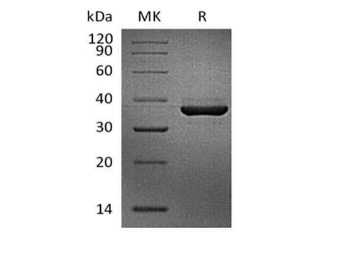 Cynomolgus FGL1 / Hepassocin Protein (Recombinant AVI-6His, C-terminus)