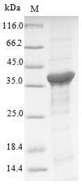 Human ATP6AP2 / Renin Receptor Protein (Recombinant 10His, N-terminus)