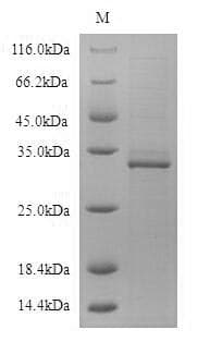 Human CD19 Protein (Recombinant 6His, N-terminus)