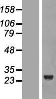 CCDC103 Protein (Over-Expression Lysate Myc-DDK (Flag))