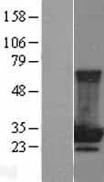 MOBKL2B / MOB3B Protein (Over-Expression Lysate Myc-DDK (Flag))