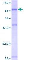 Human IEF-SSP-9502 / PWP1 Protein (Recombinant GST)