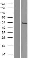 Human CYP21A2 Protein (Over-Expression Lysate Myc-DDK (Flag))