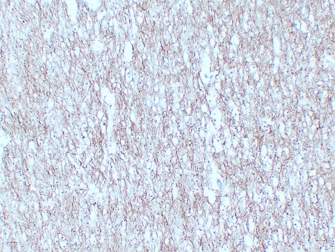 NF-L / NEFL Antibody (clone ABT-NF)