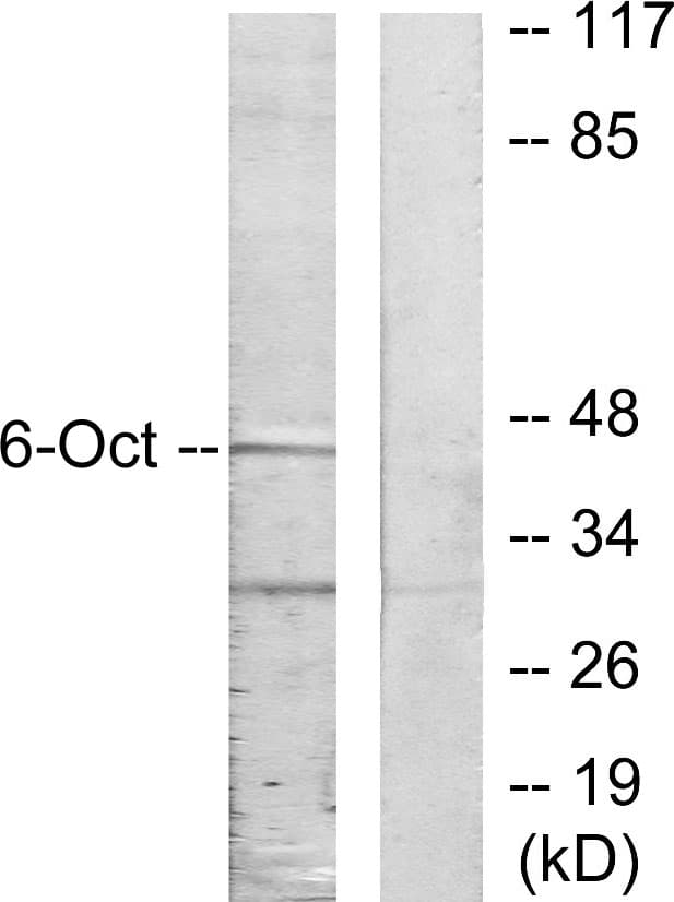 POU3F1 / OCT6 Antibody (aa311-360)