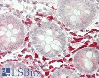 IHC-plus™ CRIP1 Antibody (aa48-77)