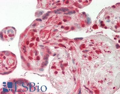 MLKL Antibody (aa107-156)