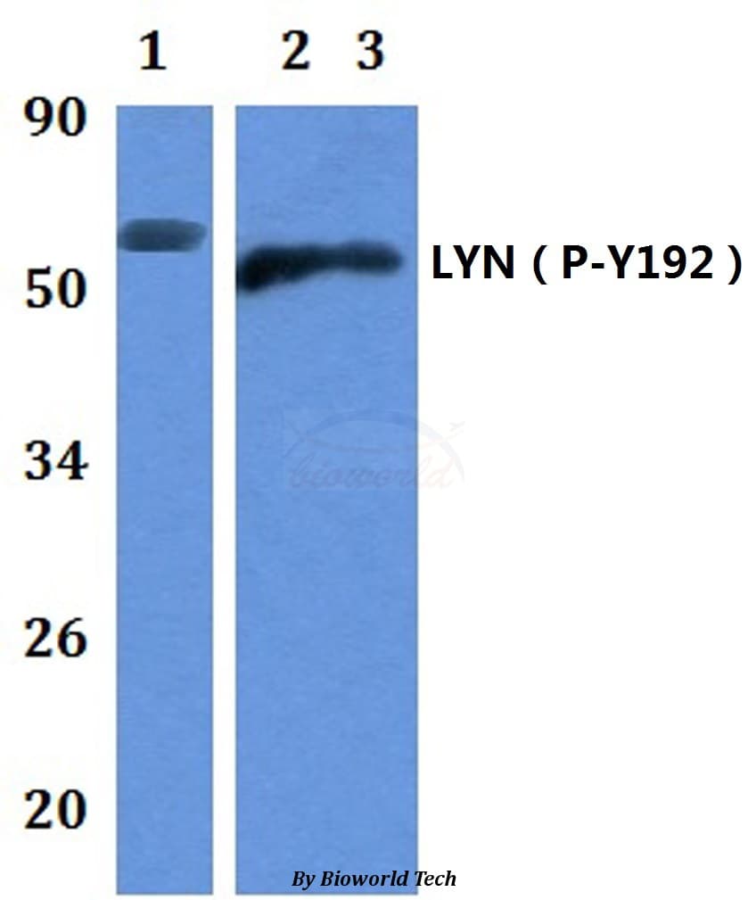 LYN Antibody (phospho-Tyr192)
