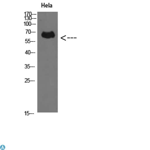 PRF1 / Perforin Antibody