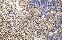 IL22 Antibody (aa148-177)