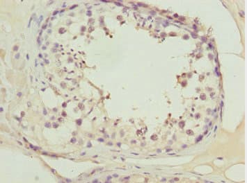 ATOH7 / MATH5 Antibody
