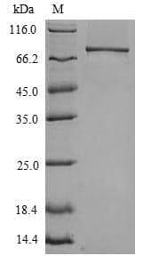 Mouse TLR4 Protein (Recombinant 6His, N-terminus)