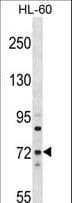 MTMR6 Antibody (aa114-143)