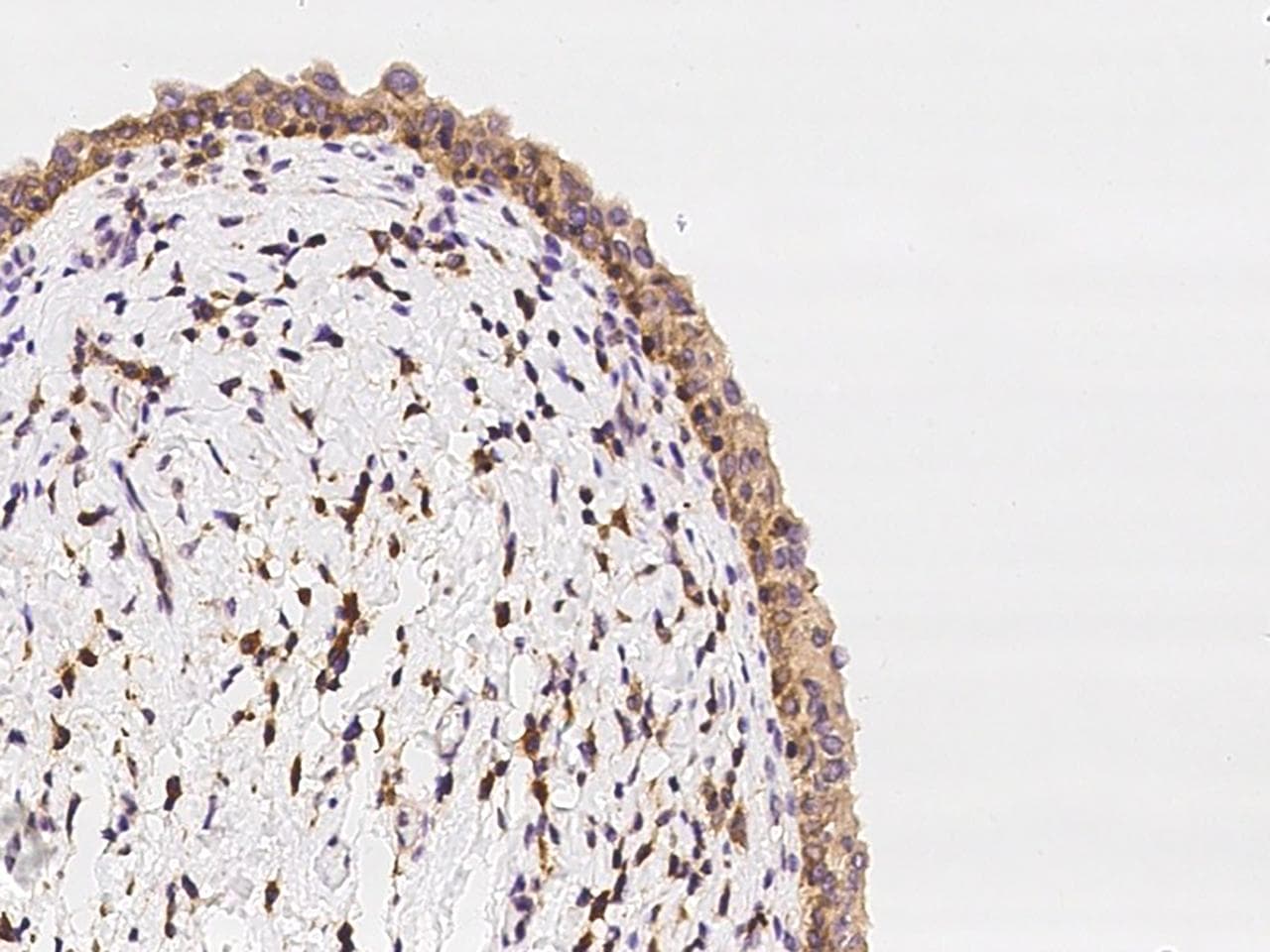 OSBPL3 Antibody