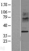 Human CCR2 Protein (Over-Expression Lysate Myc-DDK (Flag))
